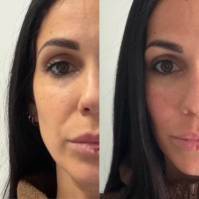 Venus_beforeafter