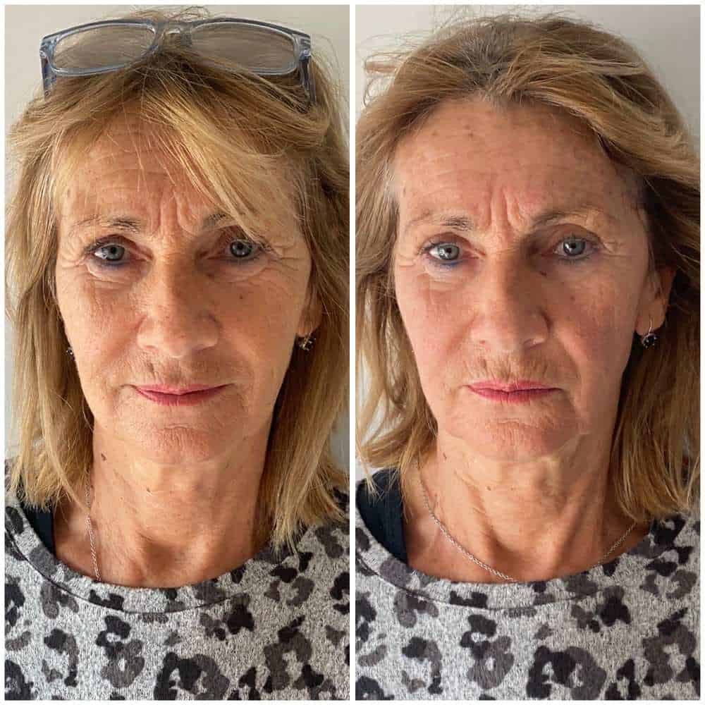 Venus_beforeafter3