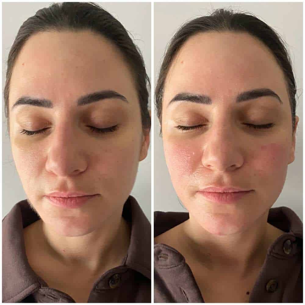 Venus_beforeafter4
