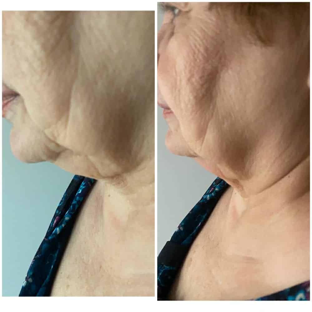 Venus_beforeafter5