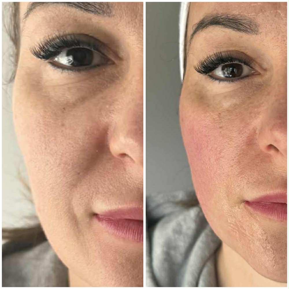Venus_beforeafter6