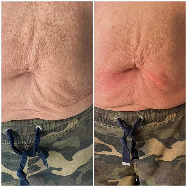 Venus_beforeafter7