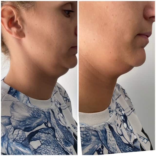 Venus_beforeafter8